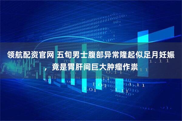 领航配资官网 五旬男士腹部异常隆起似足月妊娠，竟是胃肝间巨大肿瘤作祟